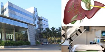 ಸಹ್ಯಾದ್ರಿ ನಾರಾಯಣ ಆಸ್ಪತ್ರೆಯ ಸಾಧನೆ: ವಯೋವೃದ್ಧರಿಗೆ ಯಶಸ್ವಿ ಲಿಥೊಟ್ರಿಪ್ಸಿ ಚಿಕಿತ್ಸೆ