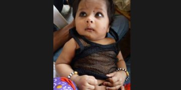 ಹಾವು ಕಚ್ಚಿ 14 ತಿಂಗಳ ಮಗು ಧಾರುಣ ಸಾವು