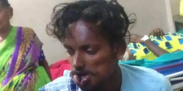 ನಾಗರ ಹಾವಿಗೆ ಮುತ್ತು ಕೊಡಲು ಹೋಗಿ ಆಸ್ಪತ್ರೆ ಸೇರಿದ ಯುವಕ