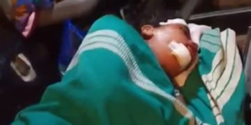 ಚಲಿಸುತ್ತಿದ್ದ ಬಸ್’ನಿಂದ ಹಾರಿದ ಮೂವರು: ಓರ್ವನ ಸ್ಥಿತಿ ಗಂಭೀರ