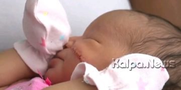 ಸಿಸೇರಿಯನ್ ವೇಳೆ ಶಿಶುವಿನ ಕೆನ್ನೆಯನ್ನೇ ಕೊಯ್ದ ವೈದ್ಯರು: ಎಷ್ಟು ಹೊಲಿಗೆ ಹಾಕಲಾಗಿದೆ ಗೊತ್ತಾ?