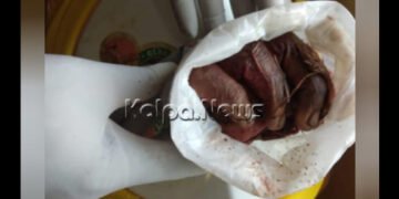 ಭತ್ತ ಒಕ್ಕುವ ಯಂತ್ರಕ್ಕೆ ಸಿಲುಕಿ ಕೈ ಕಳೆದುಕೊಂಡು ರೈತ!