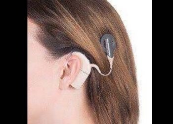 ಶಿವಮೊಗ್ಗದ ಮೆಗ್ಗಾನ್‌ನಲ್ಲಿ ಕಾಕ್ಲಿಯರ್ ಇಂಪ್ಲಾಂಟ್ ಶಸ್ತ್ರಚಿಕಿತ್ಸೆ: ಇಲ್ಲಿದೆ ಮಾಹಿತಿ