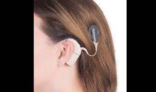 ಶಿವಮೊಗ್ಗದ ಮೆಗ್ಗಾನ್ನಲ್ಲಿ ಕಾಕ್ಲಿಯರ್ ಇಂಪ್ಲಾಂಟ್ ಶಸ್ತ್ರಚಿಕಿತ್ಸೆ: ಇಲ್ಲಿದೆ ಮಾಹಿತಿ