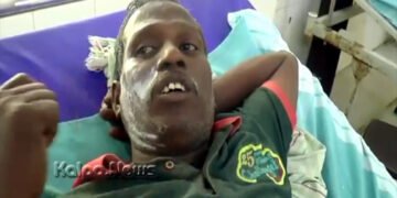 ಹೊಟೇಲ್ ಮಾಲೀಕನಿಗೆ ಕಾದ ಎಣ್ಣೆ ಎರಚಿದ ಗ್ರಾಹಕ | ಕಾರಣ ಮಾತ್ರ ಯಕಶ್ಚಿತ್!