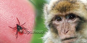 ಮಂಗನ ಕಾಯಿಲೆ | ಸಿದ್ದಾಪುರದ ಮಹಿಳೆ ಶಿವಮೊಗ್ಗದಲ್ಲಿ ಸಾವು