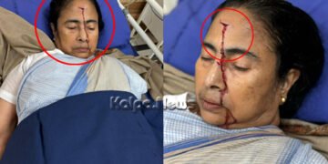 ಪಶ್ಚಿಮ ಬಂಗಾಳ ಸಿಎಂ ಮಮತಾ ಬ್ಯಾನರ್ಜಿಗೆ ಗಂಭೀರ ಗಾಯ | ಇಷ್ಟಕ್ಕೂ ಆಗಿದ್ದೇನು?