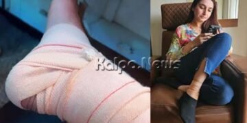 ಶೂಟಿಂಗ್ ವೇಳೆ ಅವಘಡ | ನಟಿ ರಾಗಿಣಿ ದ್ವಿವೇದಿ ಕಾಲಿಗೆ ಪೆಟ್ಟು | ಹೇಗಿದ್ದಾರೆ ಈಗ?