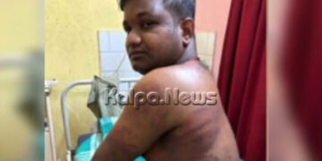 ಪಡುಬಿದ್ರಿ | ಸಾಲ ವಾಪಾಸ್ ಕೊಡಲಿಲ್ಲ ಎಂದು ಯಕ್ಷಗಾನ ಕಲಾವಿದನ ಮೇಲೆ ಹಲ್ಲೆ