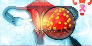 Cervical Cancer | Early Detection and Prevention Can Save Lives