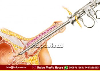 ಸಹ್ಯಾದ್ರಿ ನಾರಾಯಣ ಆಸ್ಪತ್ರೆಯಿಂದ ಮತ್ತೊಂದು ಮೈಲಿಗಲ್ಲು | 1,000 ಪ್ರಾಸ್ಟೇಟ್ ಸರ್ಜರಿ ಯಶಸ್ವಿ ಪೂರ್ಣ