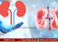 ಮೂತ್ರಪಿಂಡದ ಕಾಯಿಲೆ | ಒಂದು ನಿಶಬ್ದ ಹಂತಕ, ಇದನ್ನು ನೀವು ತಡೆಯಬಹುದು | ಹೇಗೆ?