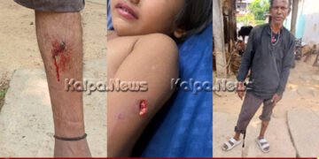 ಶಿವಮೊಗ್ಗ | ಆಟವಾಡುತ್ತಿದ್ದ ಬಾಲಕಿ ಸೇರಿ ಇಬ್ಬರ ಮೇಲೆ ಬೀದಿ ನಾಯಿ ದಾಳಿ