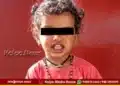 Sagara Two Year Old Child Dies Snakebite Kalasi Pete