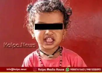 Sagara Two Year Old Child Dies Snakebite Kalasi Pete