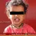 Sagara Two Year Old Child Dies Snakebite Kalasi Pete