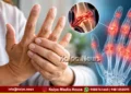 Stiff fingers Your joints may be sending an early warning