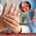 Stiff fingers Your joints may be sending an early warning